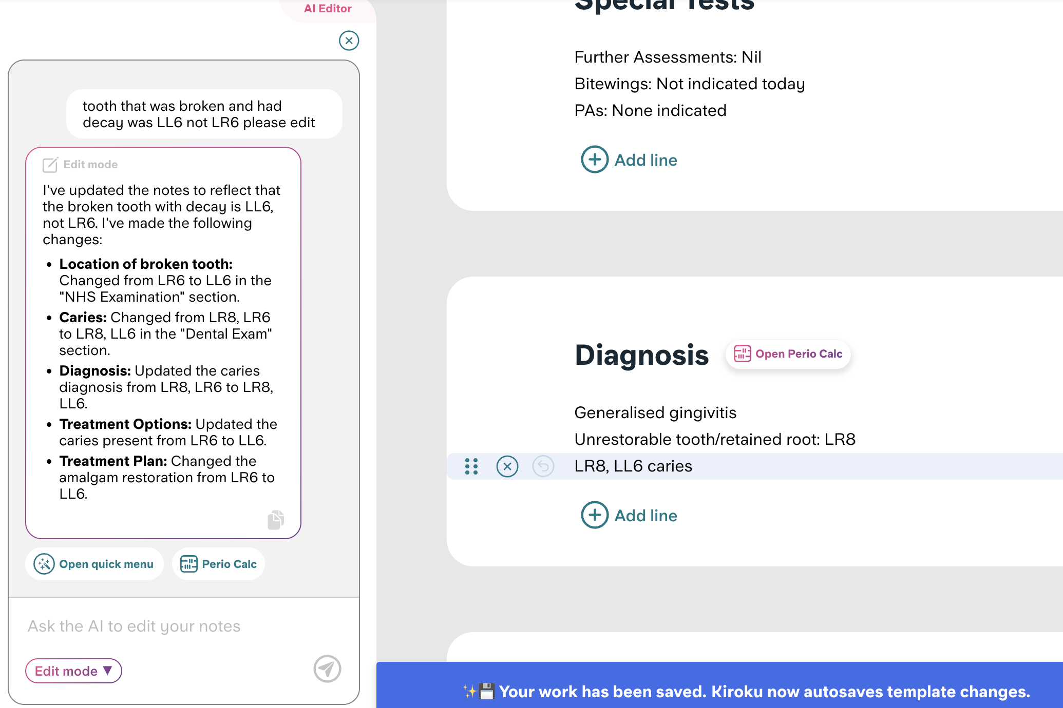 Using the Kiroku AI Editor to update your template